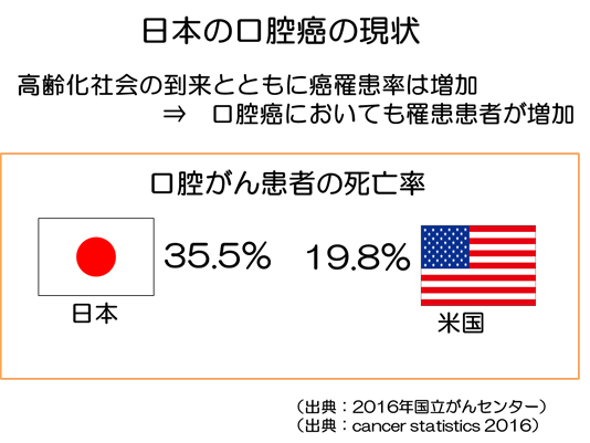 日本の口腔がんの現状
